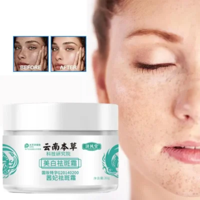 Previous Next JAPANESE MELASMA CREAM