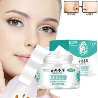 JAPANESE MELASMA CREAM